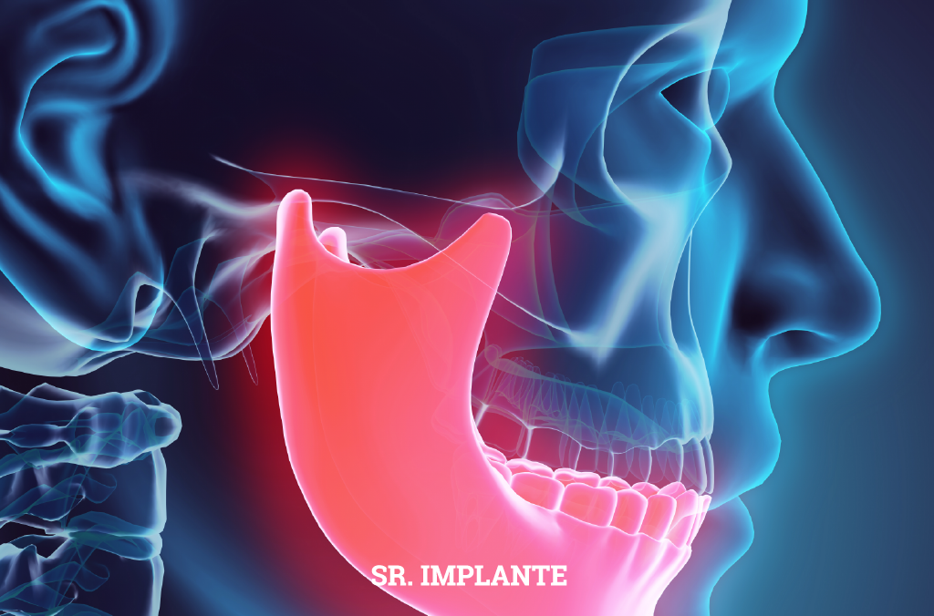 Problemas na mandíbula podem ser responsáveis por disfunções no organismo